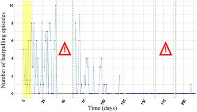 Short-term intervention complemented by wearable technology improves Trichotillomania – A naturalistic single-case report